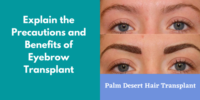 Explain the Precautions and Benefits of Eyebrow Transplant